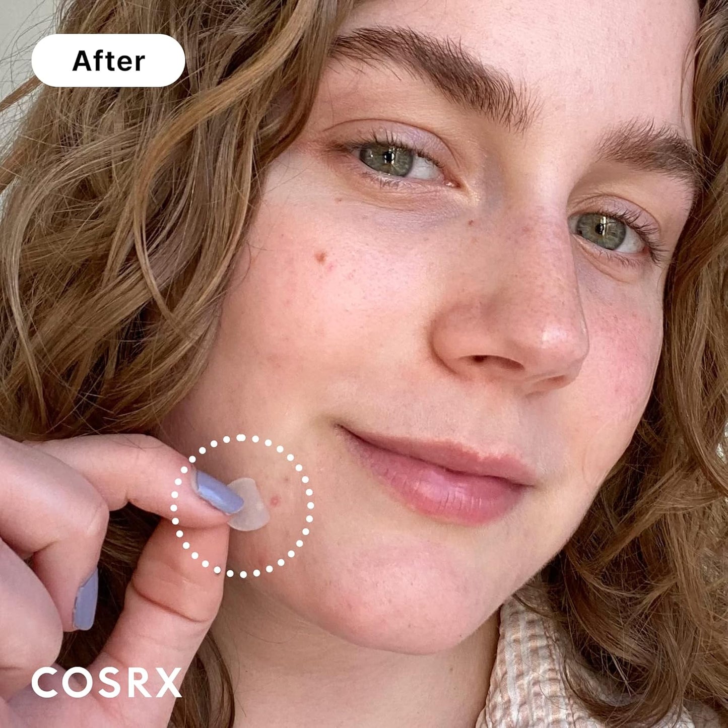 Cosrx Acne Pimple Master Patch 24ea